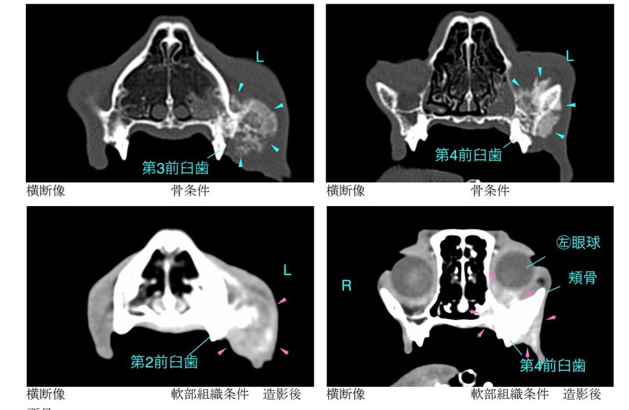 CT検査画像