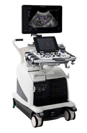 心エコー検査装置 ARIETTA 850